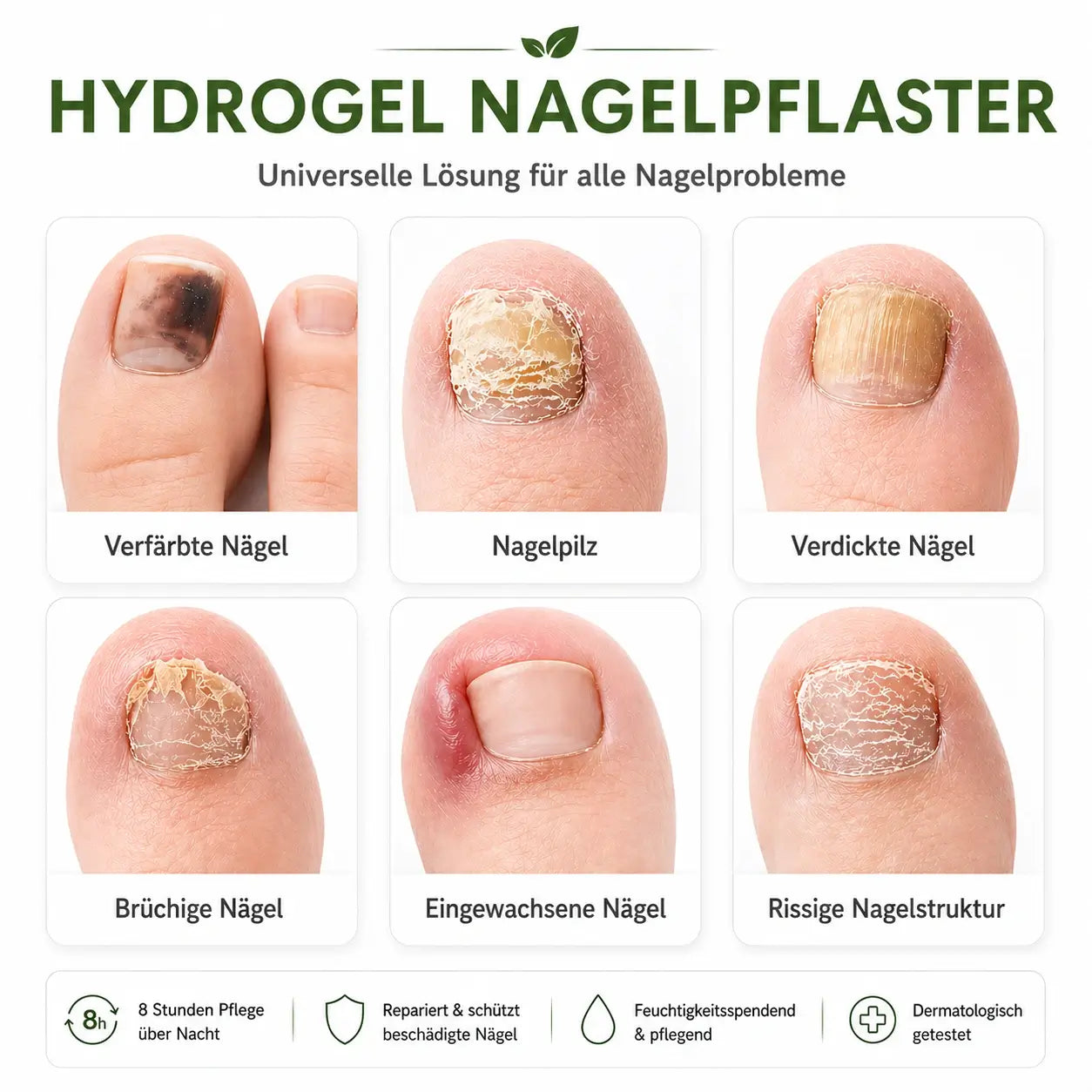 ONYCLAR™ Hydrogel Nagelpflaster
