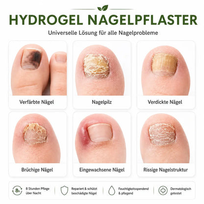 ONYCLAR™ Hydrogel Nagelpflaster