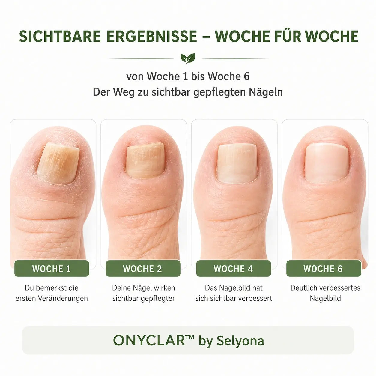 ONYCLAR™ Hydrogel Nagelpflaster
