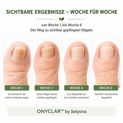 ONYCLAR™ Hydrogel Nagelpflaster